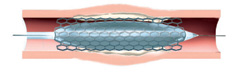 Cardio Illustration