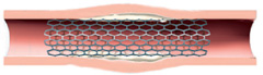 Cardio Illustration